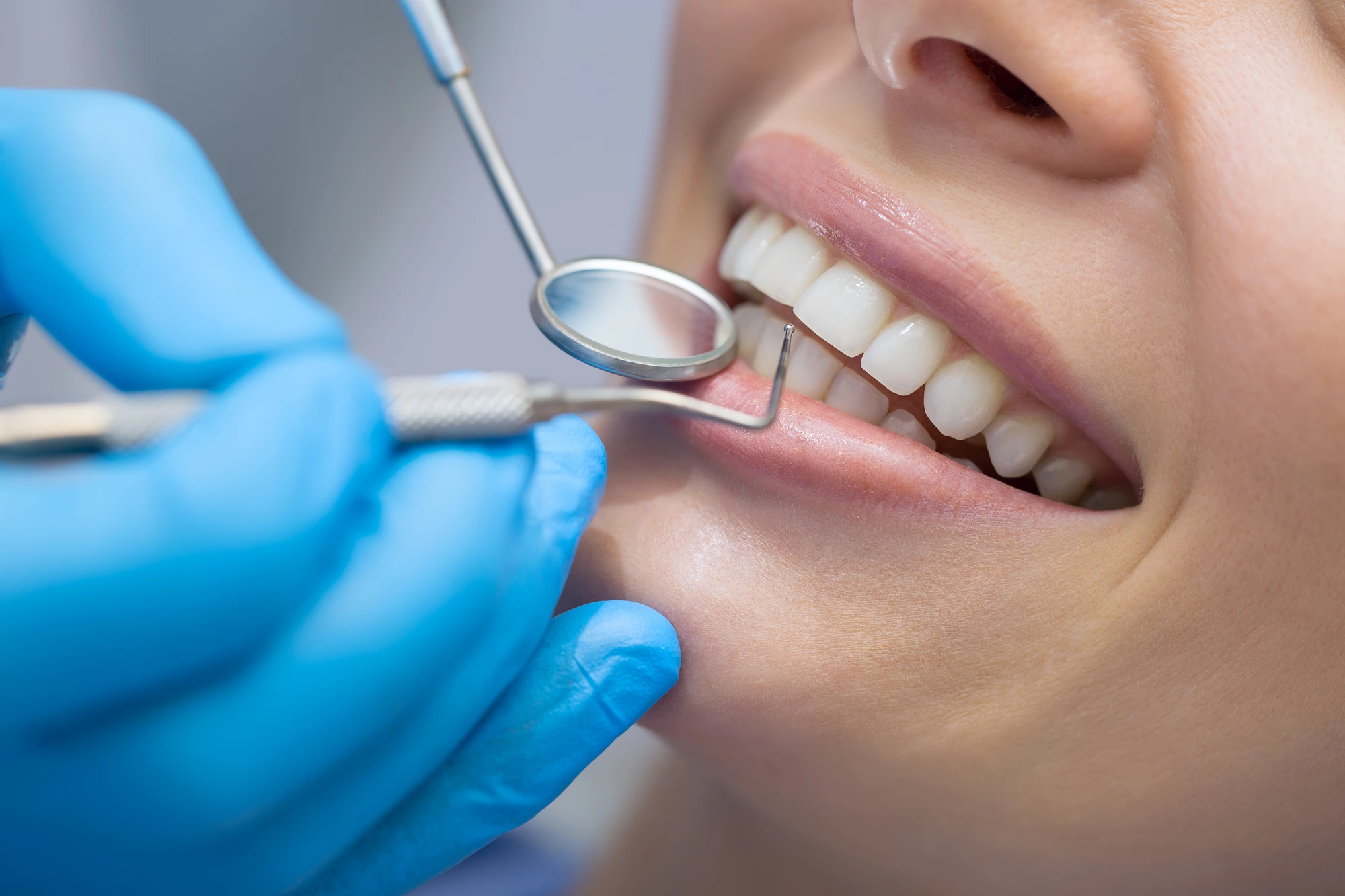 Revisión dental