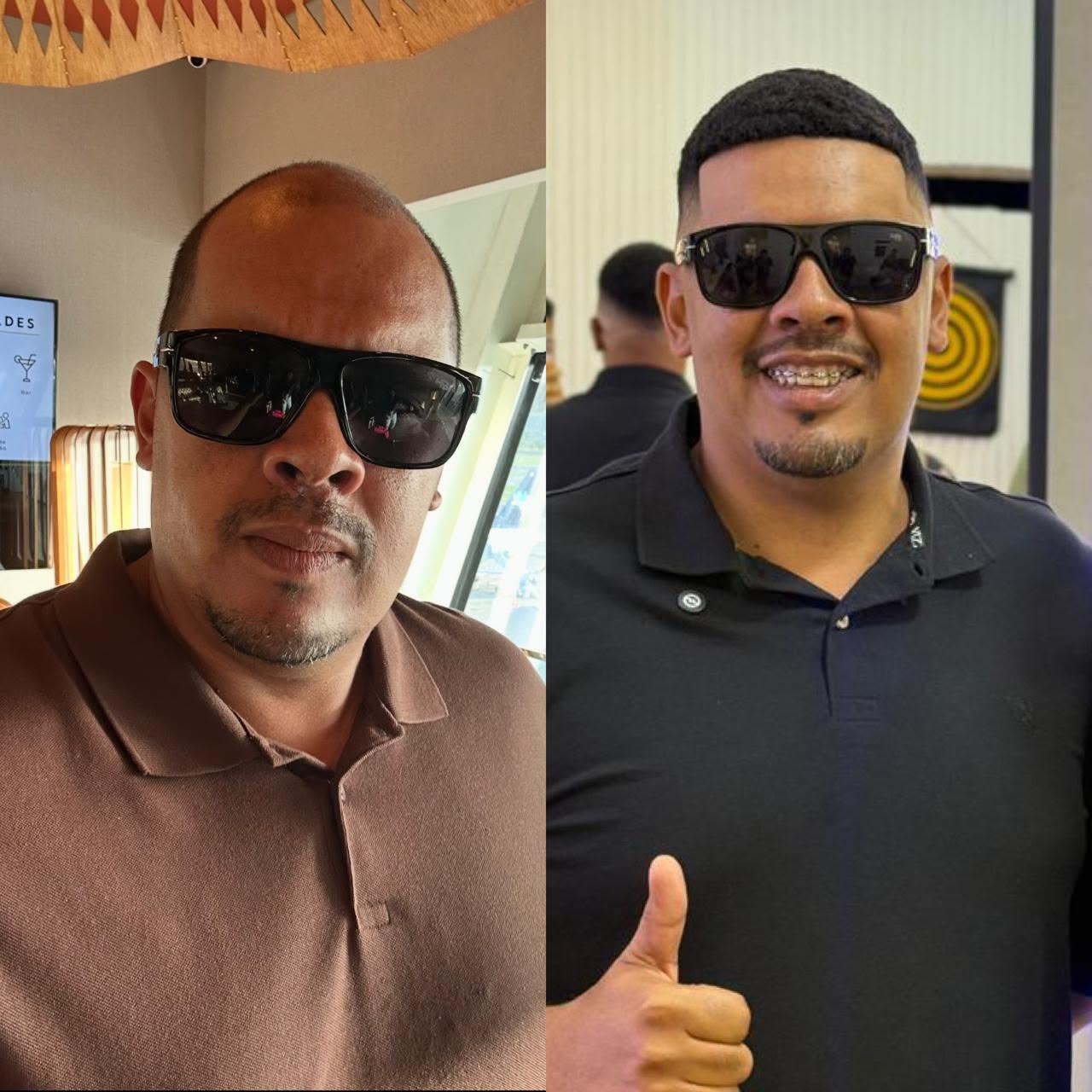 Prótese capilar — antes e depois